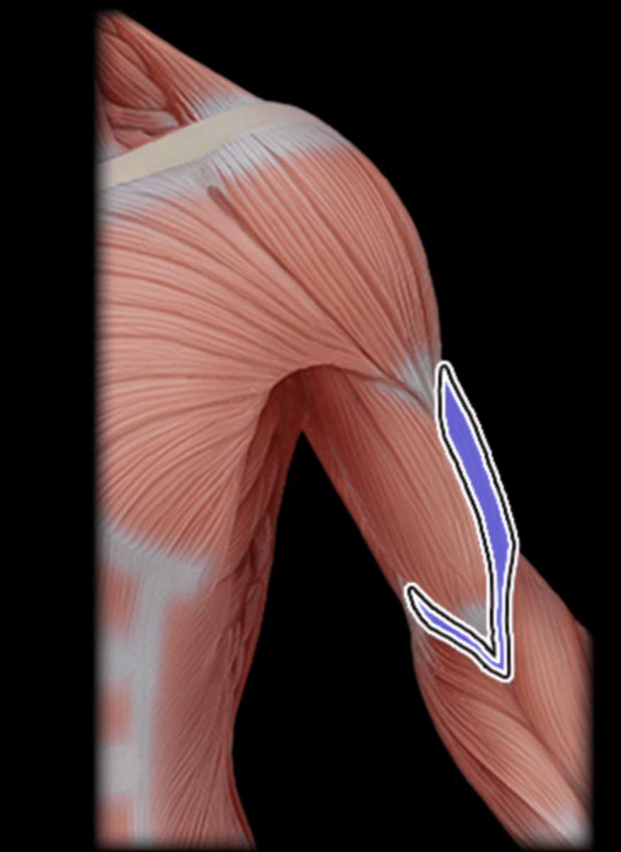 <p>What Muscle Is Highlighted?</p>