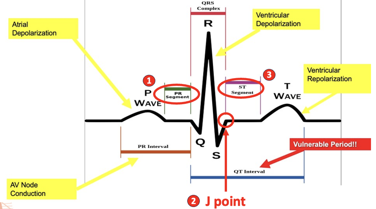 <ul><li><p>PR segment</p></li><li><p>J point</p></li><li><p>ST segment</p></li></ul><p></p>