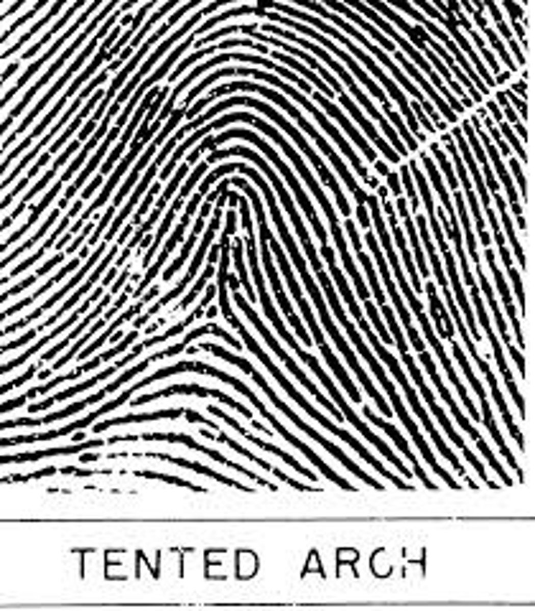 <p>The rise in the center is more pronounced and has a "tent-like" peak</p>