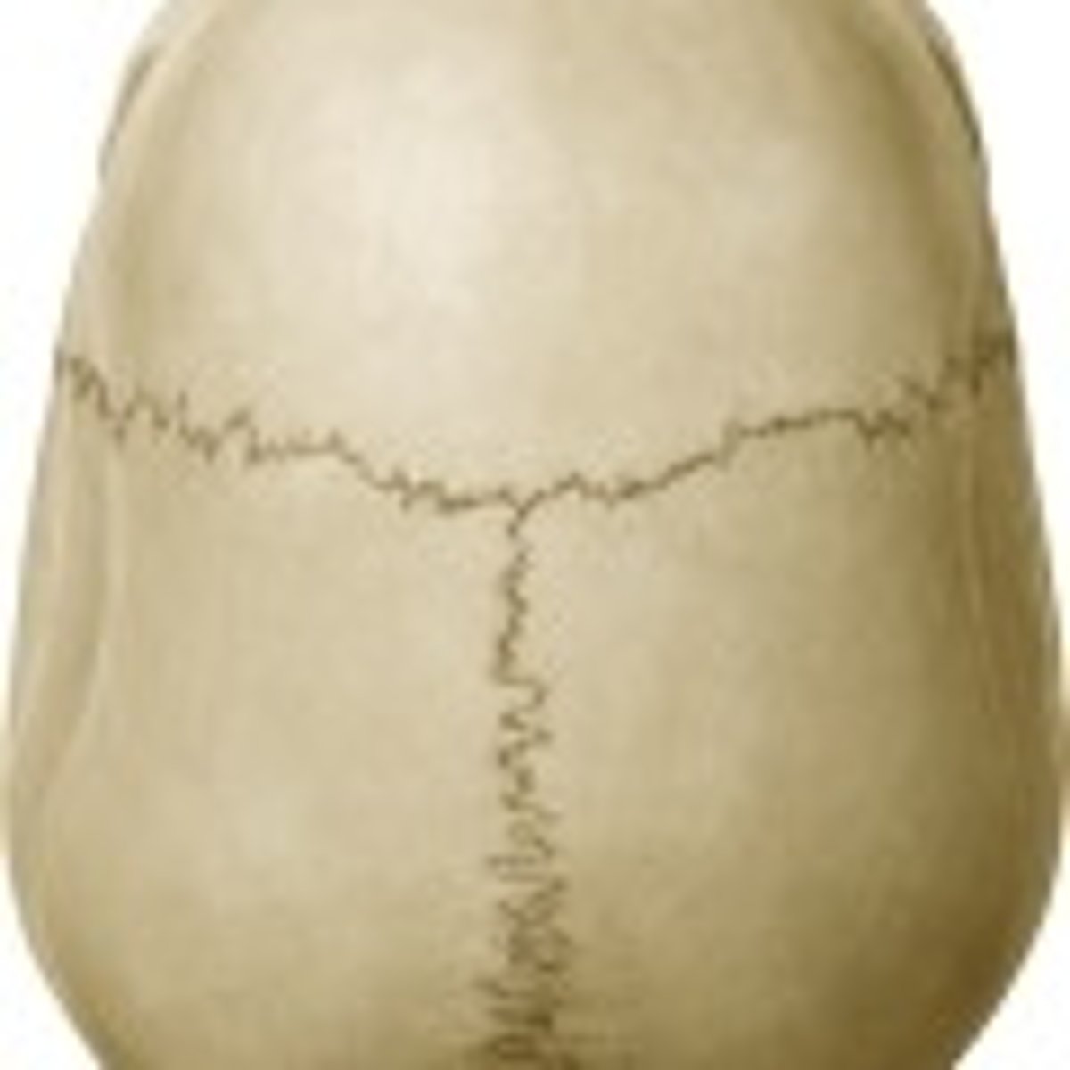 <p>The "skull cap"</p>