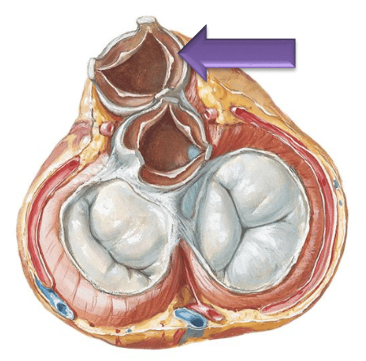 <p>The small central thickening of fibrous tissue on the free edge of the cusp.</p>