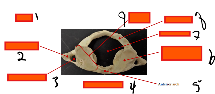 <p>#5</p>