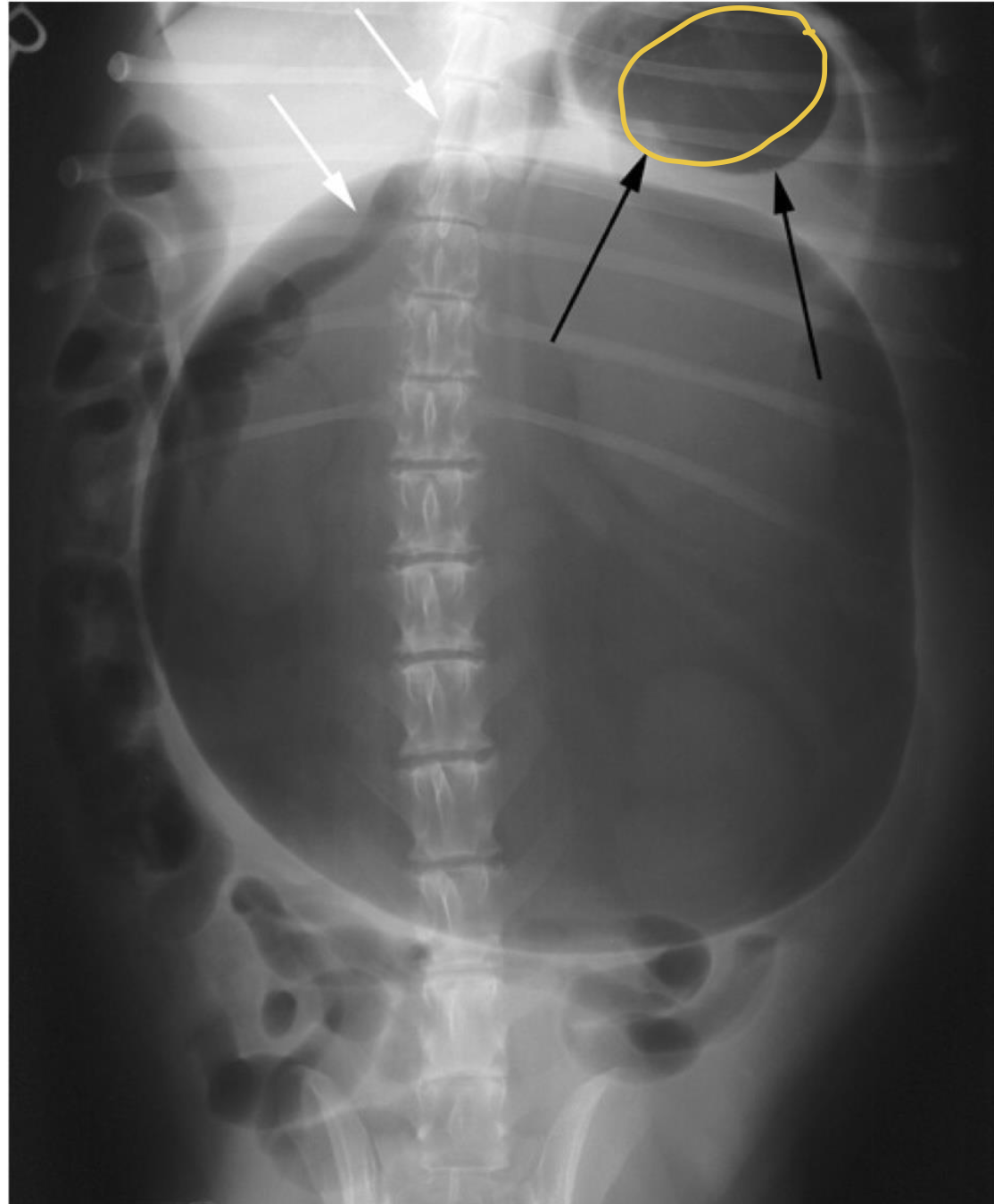 <p>what does the radiograph show?</p>