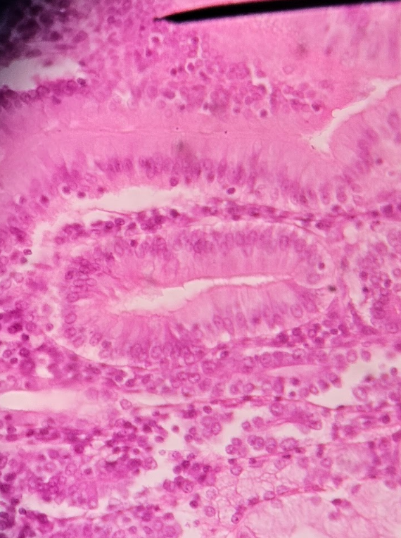 <p>columnar epithelium </p><ul><li><p>elongated cells </p></li></ul><p></p>