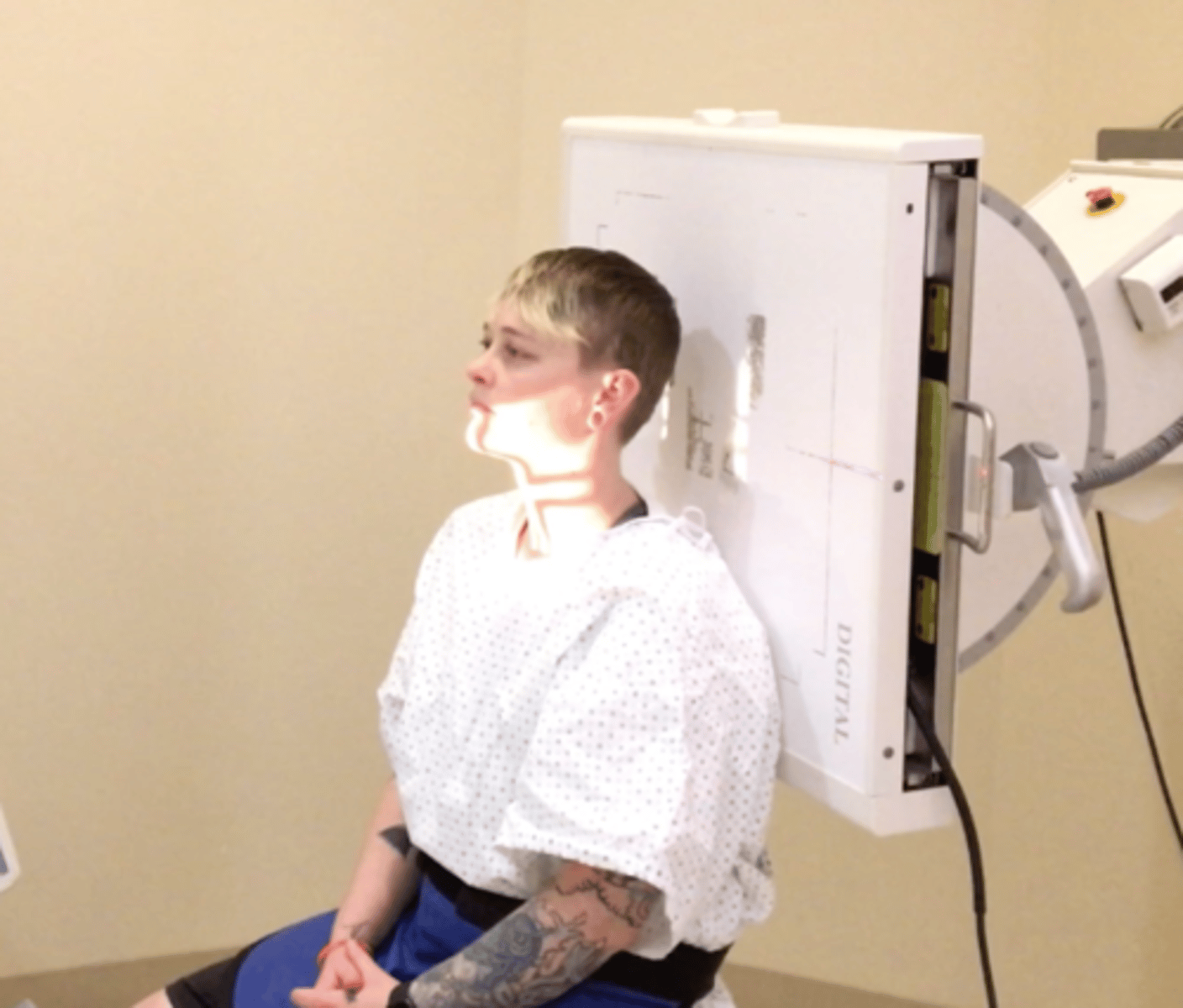 <p>Pt Placement: sitting, make sure to lift chin slightly but not touching bucky</p><p>Measure: C4 level front to back</p><p>Collimation: 8x10, to soft tissue side to side</p><p>CR Placement: C4</p><p>Tube tilt: 15 cephalic</p><p>SID: 40"</p><p>Breathing: DBDM</p>