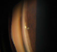 <p>identify </p>