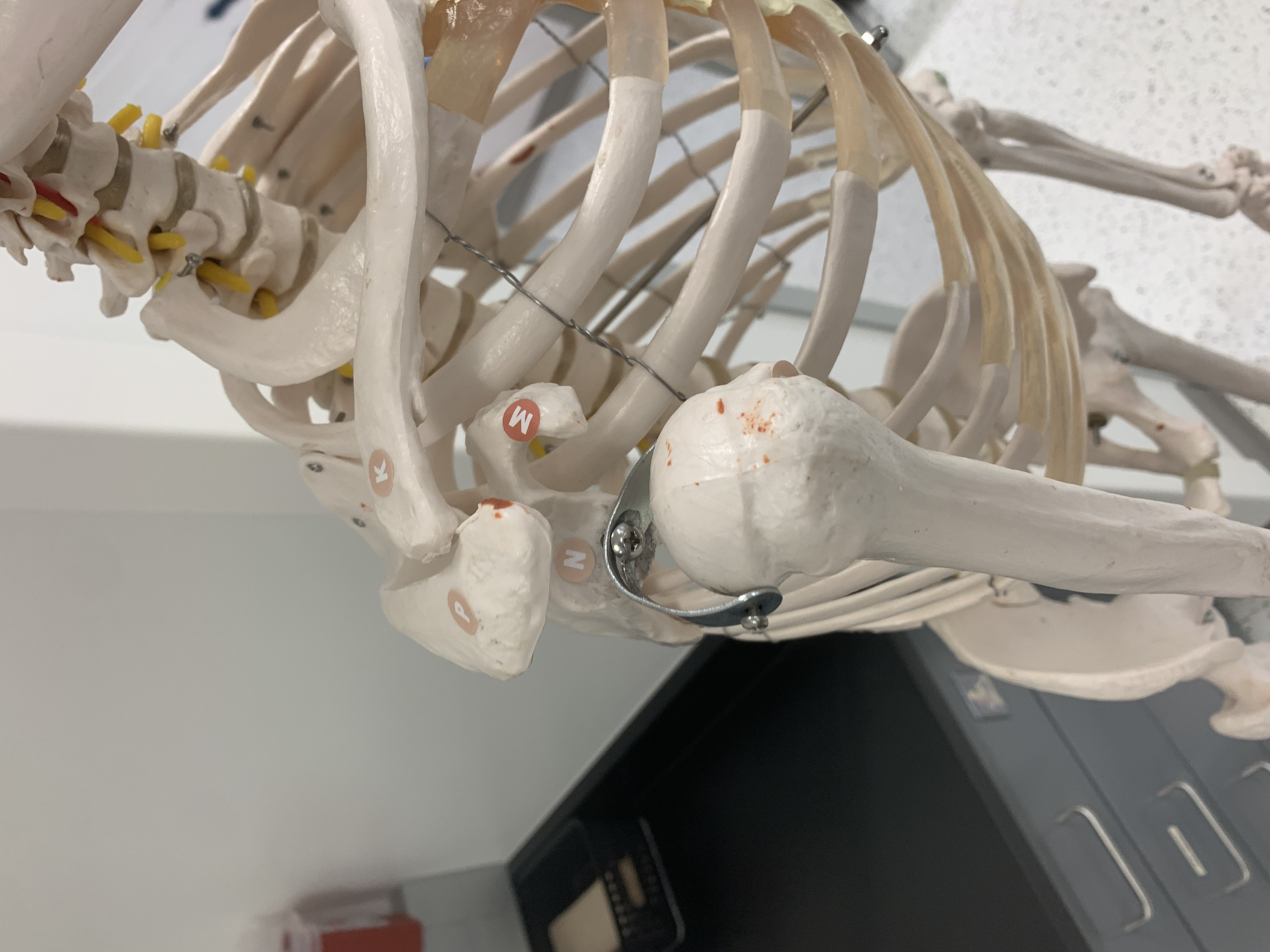 <p>Coracoid Process</p>