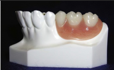 <p>what is a precision attachment? (long)</p>