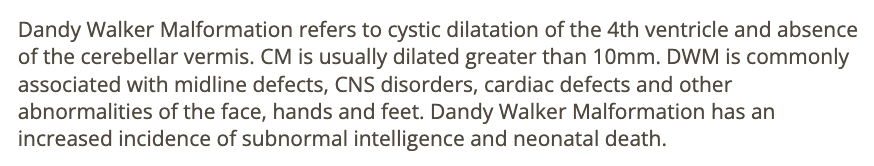 <p>a) dandy walker malformation</p>