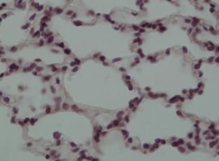 <p>what kind of epithelium is this made of </p>