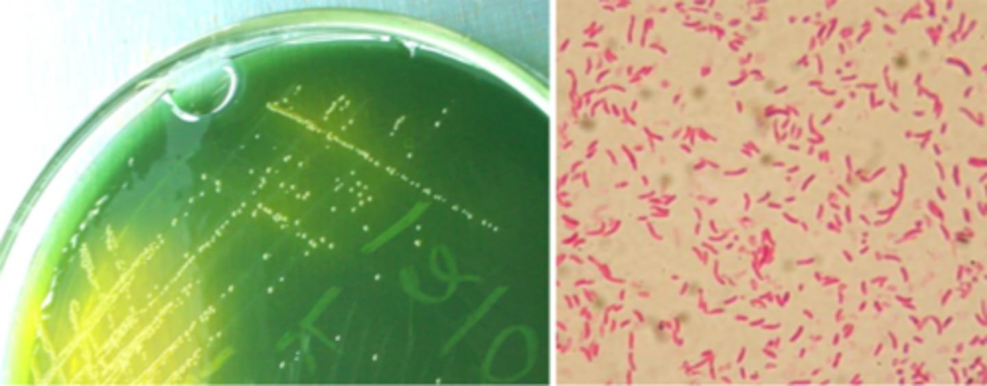 <p>-Oxidase-positive</p><p>-Tolerates 6% NaCl</p><p>-Thiosulfate citrate bile salts sucrose (TCBS) agar</p><p>-curved bacilli </p><p>V. cholerae: pandemics; munches on sucrose (yellow)</p><p>V. parahaemolyticus: #1 Vibrio in US (seafood)</p><p>V. vulnificus: #1 Vibrio cause of death in US</p>