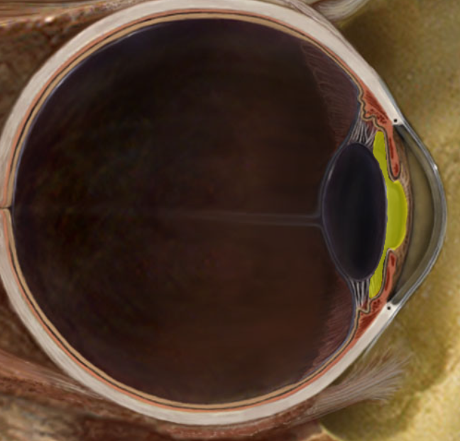 term image