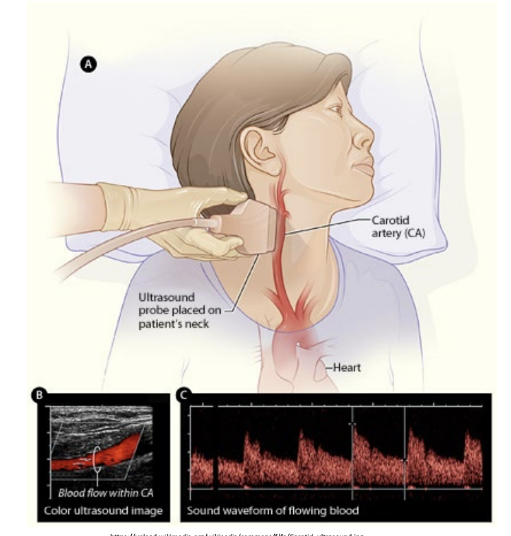 <p>Soundwaves are reflected back based on the density of tissues.</p><p>The denser a tissue, the more soundwaves are reflected, hence the whiter the colour on the ultrasound.</p>