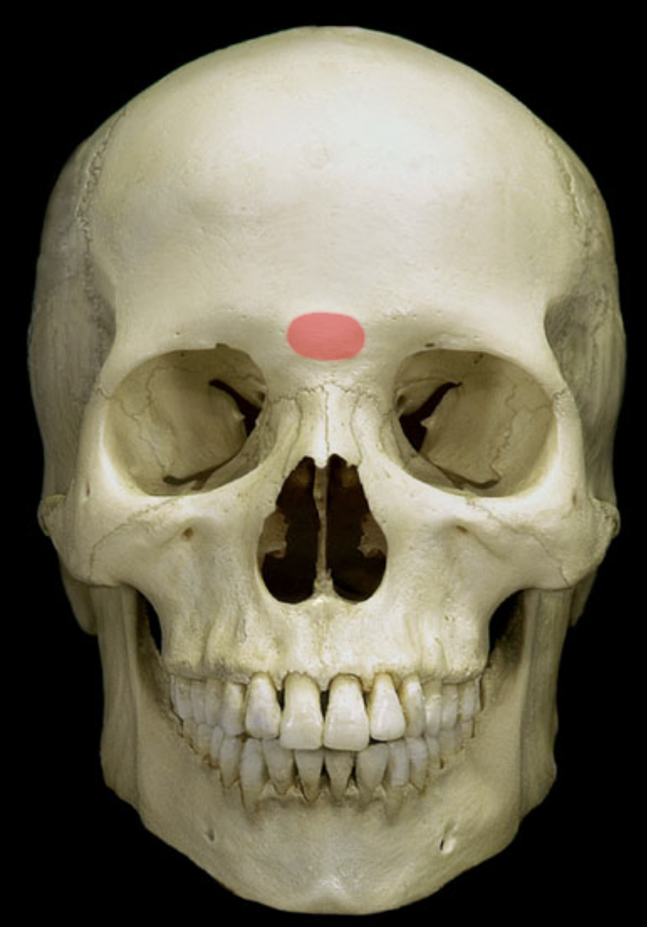term image