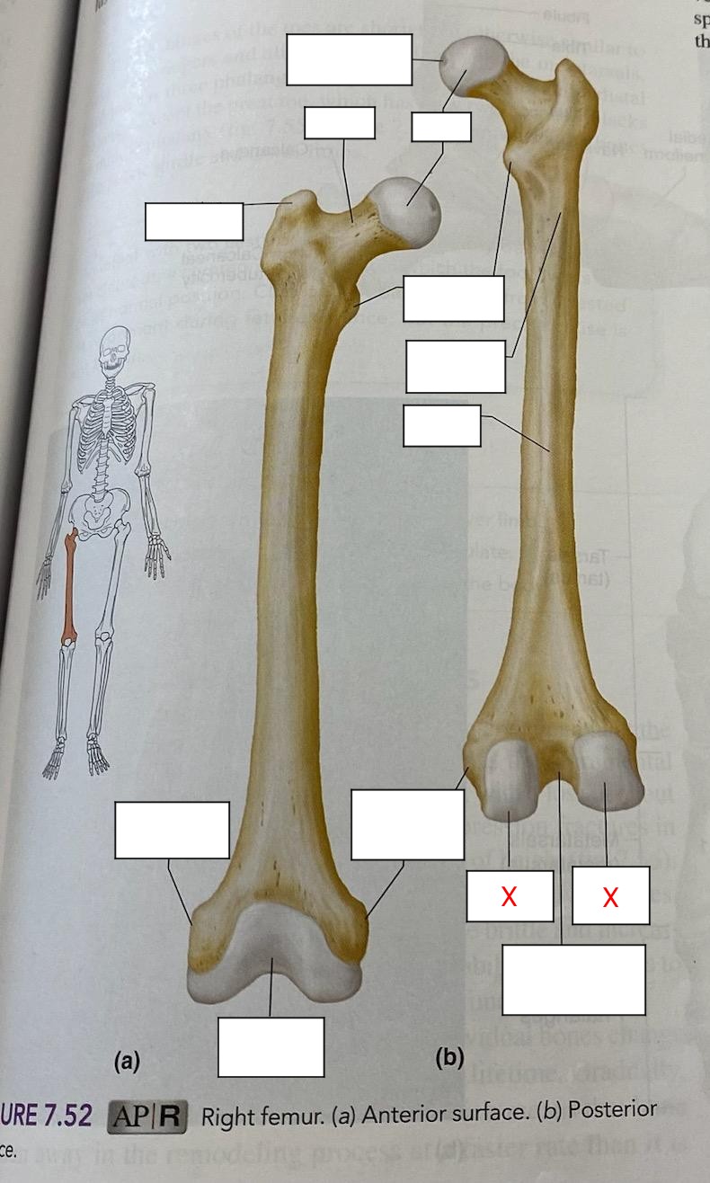round articular surfaces