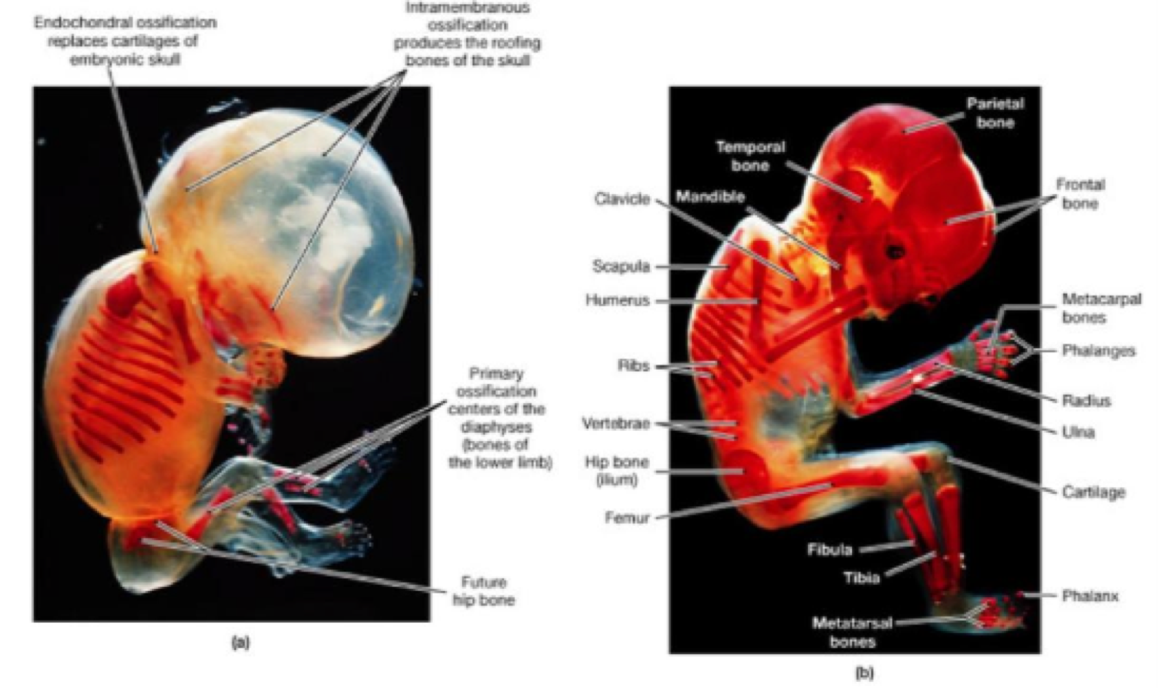 <p>endochondra ossification&nbsp;</p>