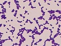 <p>What Bacterial Arrangement?</p>
