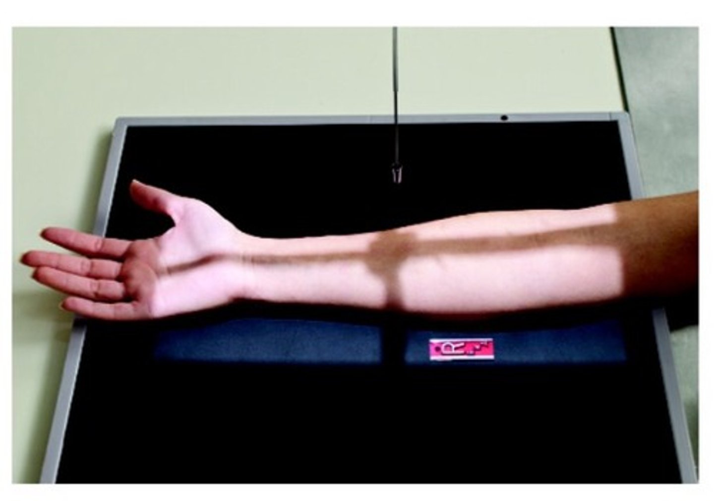 <p>CR perpendicular to mid-forearm</p>