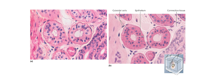 <p>Stratified cuboidal epithelium</p>