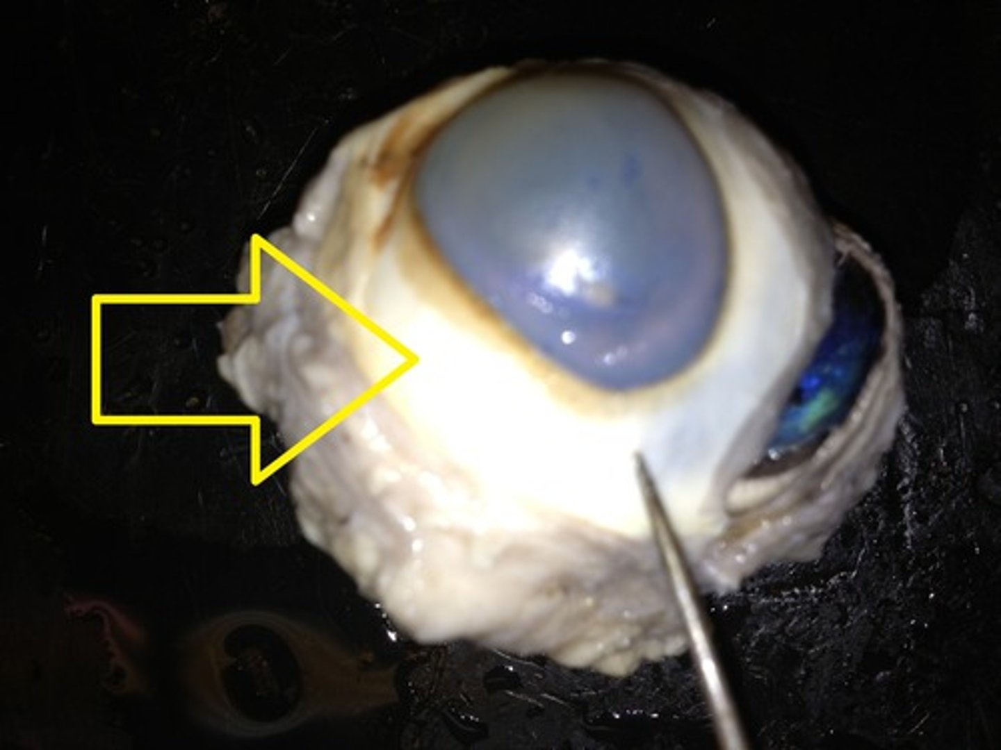 <p>Attachment site for eye muscle</p>