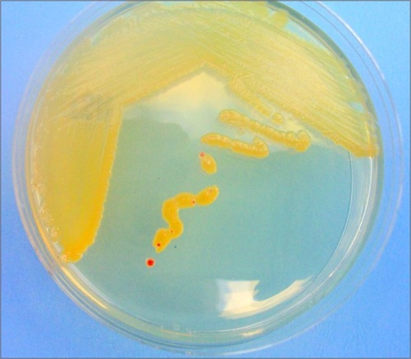 <p>Error in streaking:</p>