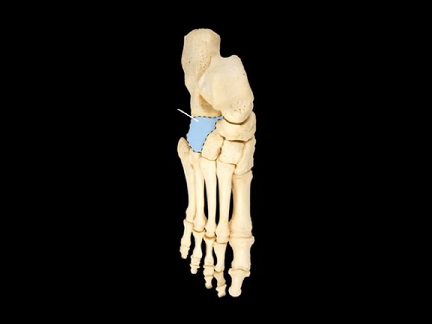 <p>Cuboid of the tarsal</p>