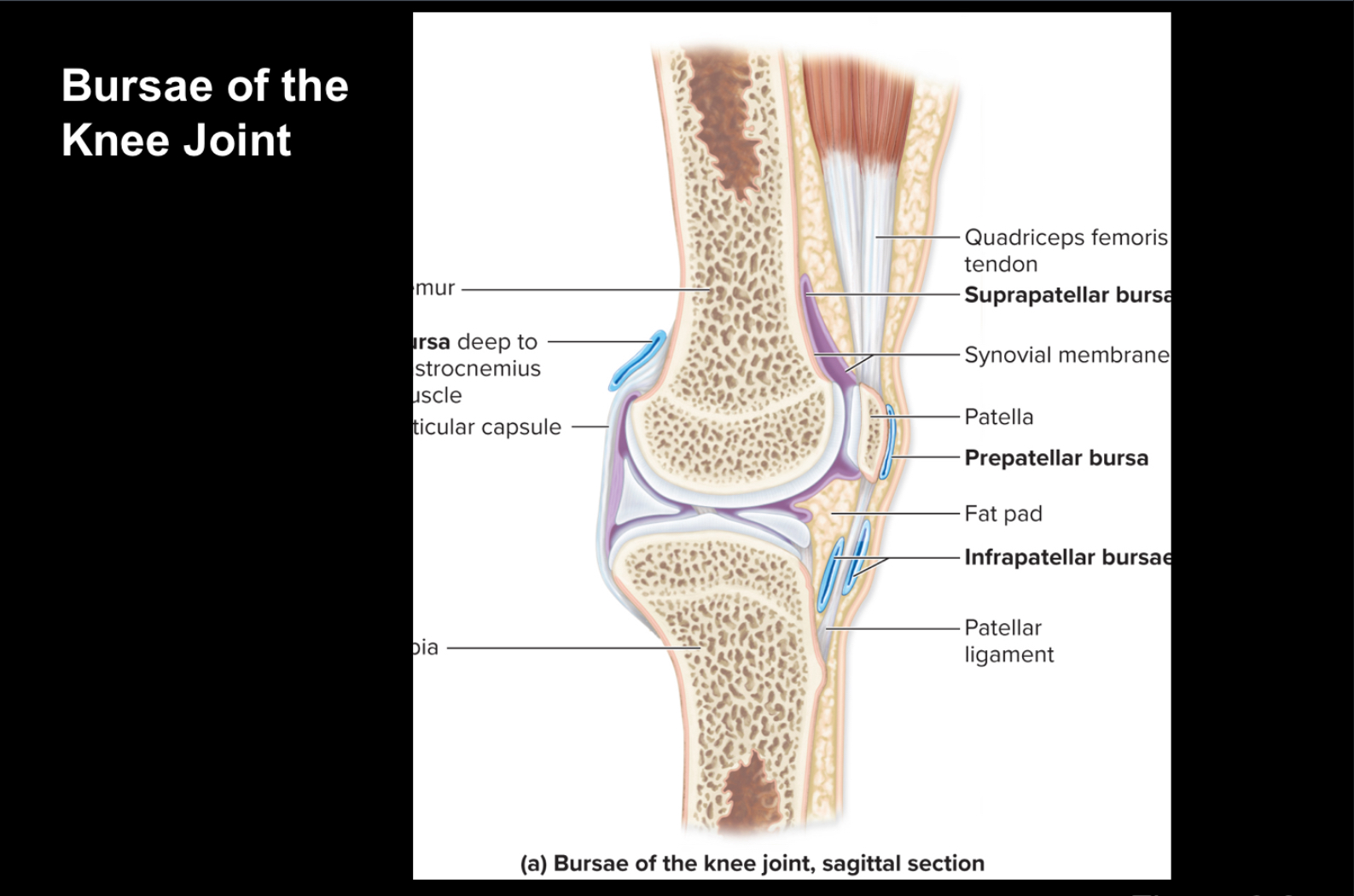 <p>Fibrous sac-like structure containing synovial fluid lined internally by synovial membrane</p>