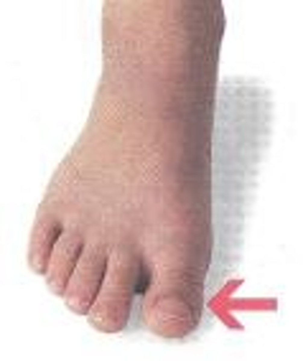 <p>any of the five separate parts at the end of the foot:</p>