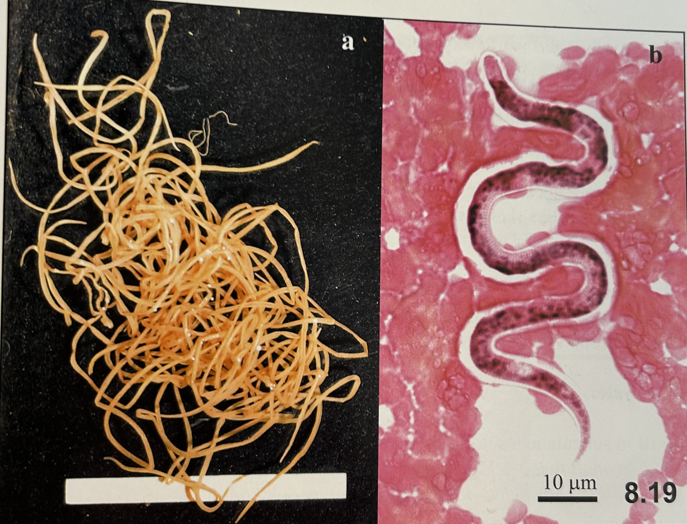 <p>characteristics of </p><p>Dirofilaria immitis (adults)?</p>
