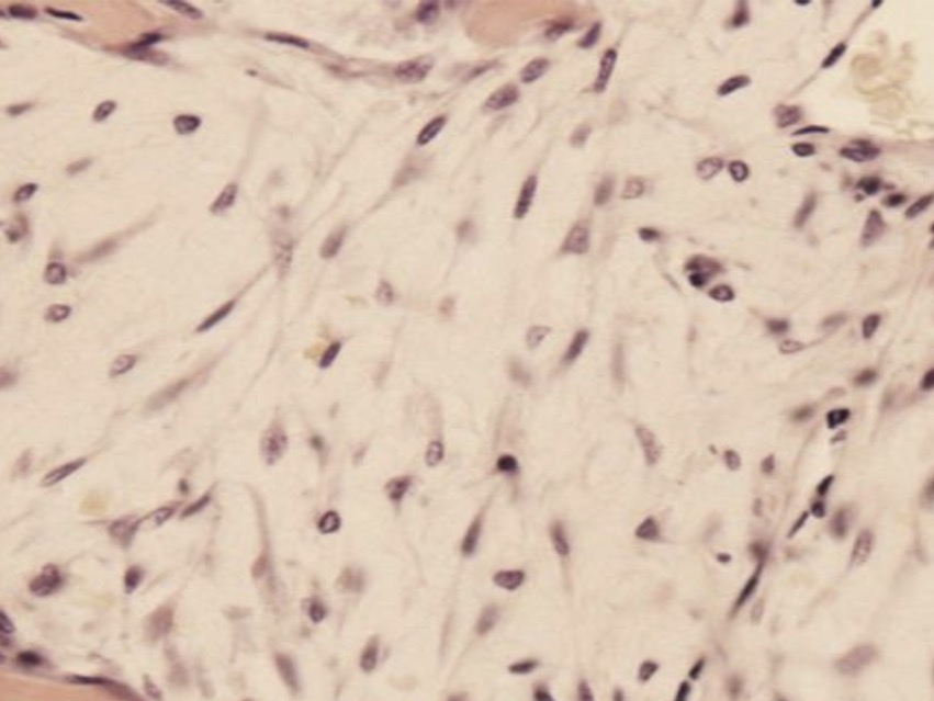 <p>Mezenchimines lasteles + tarplasteline medziaga (pagr medz. ir kolageno skaidulos)</p>