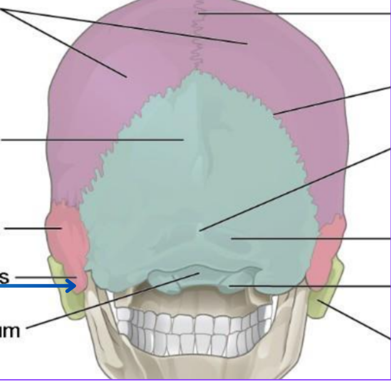 term image
