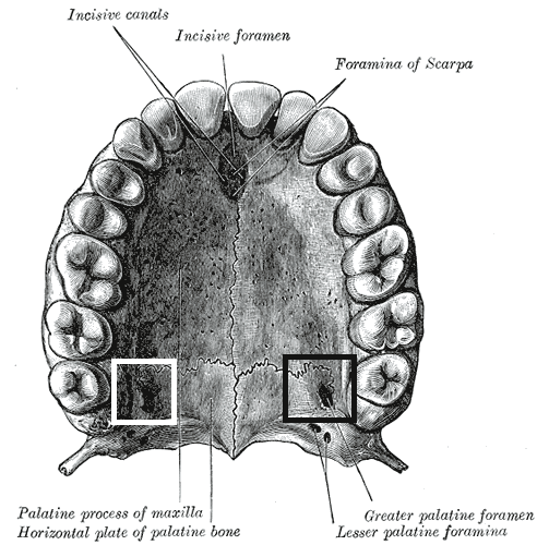 <p>Name the greater palatine foramen</p>
