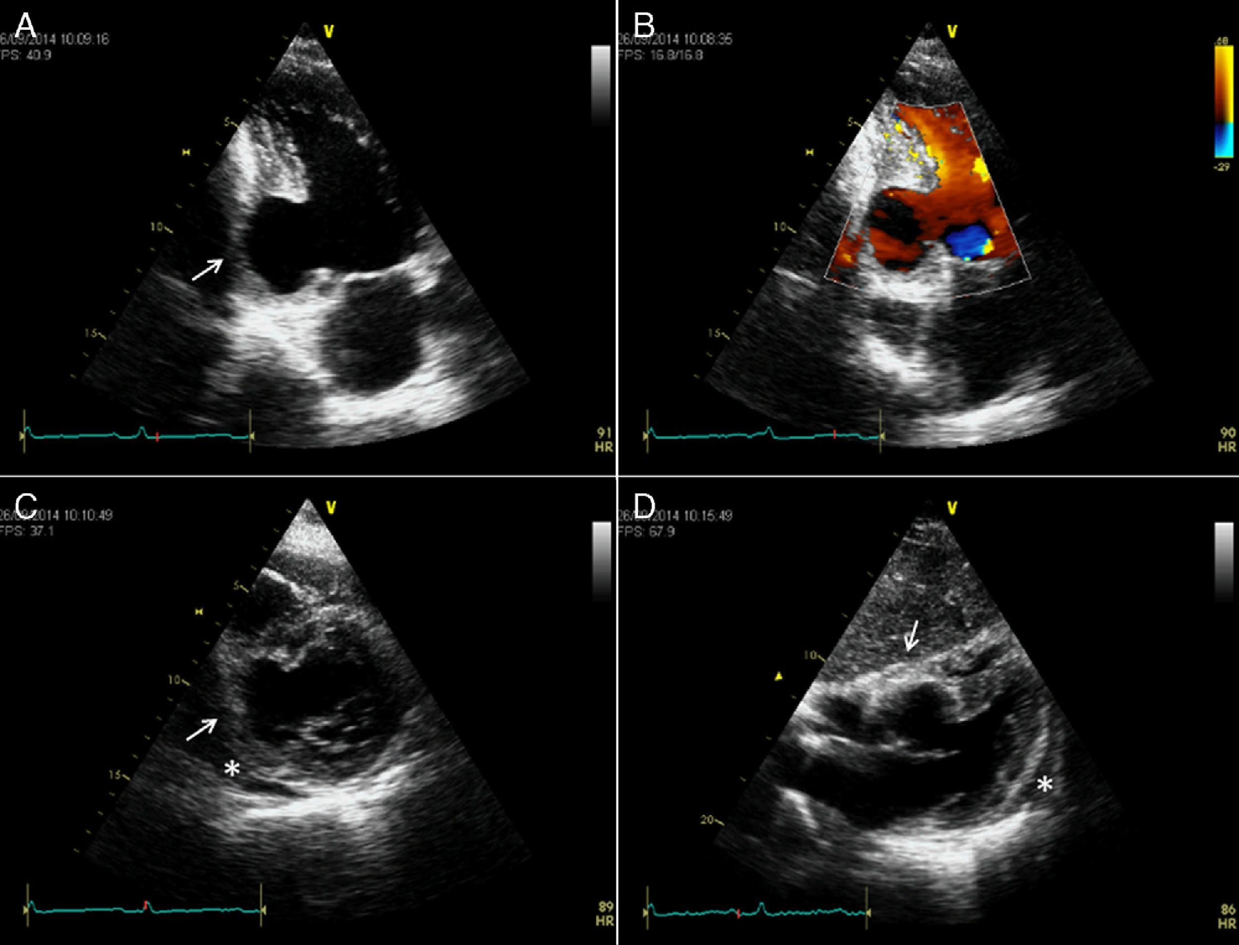 <p>What is seen in the 2D image?</p>