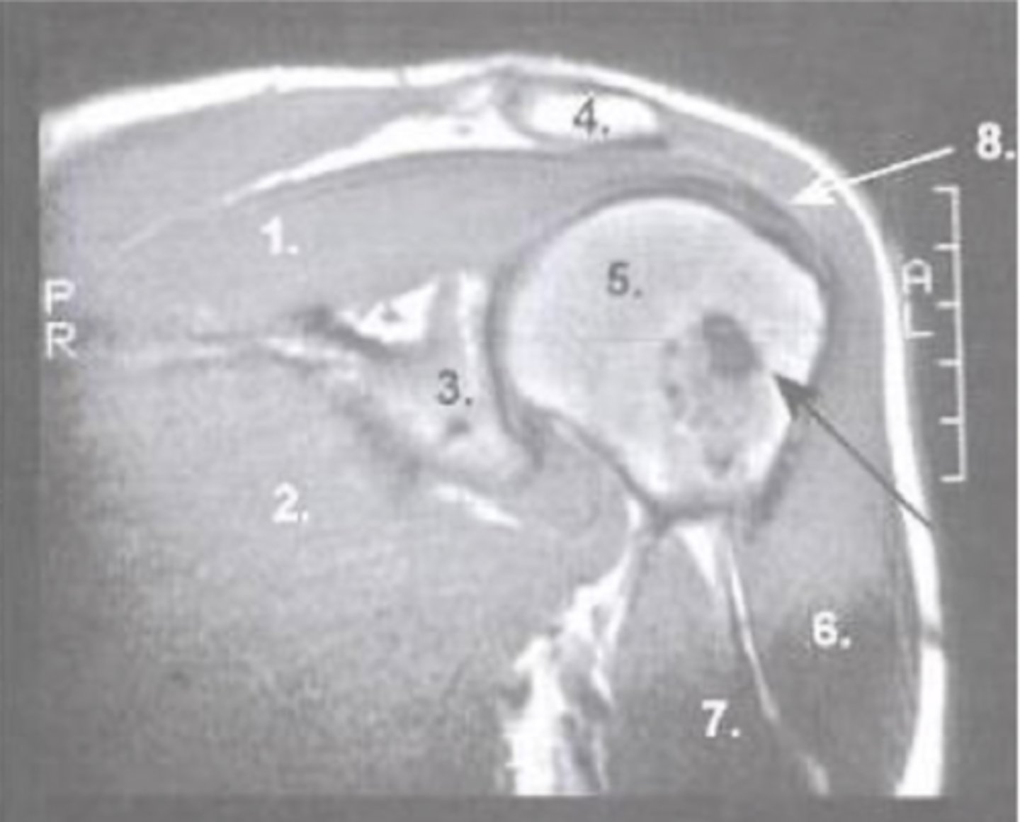 <p>What is number 1?</p>