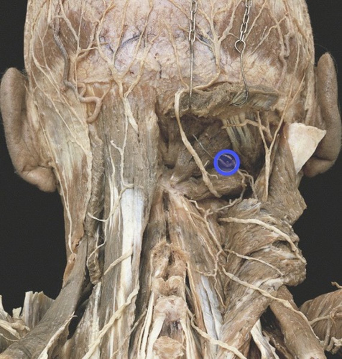 knowt flashcard image