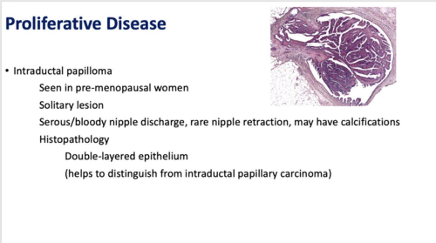 <p>Intraductal papilloma</p>