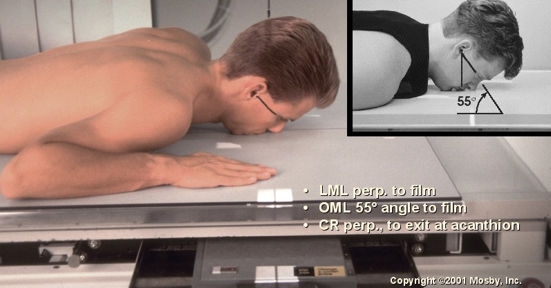 <p>What position is this?</p>