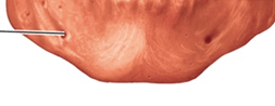 <p>What is the name of thsi bone in the skull?</p>