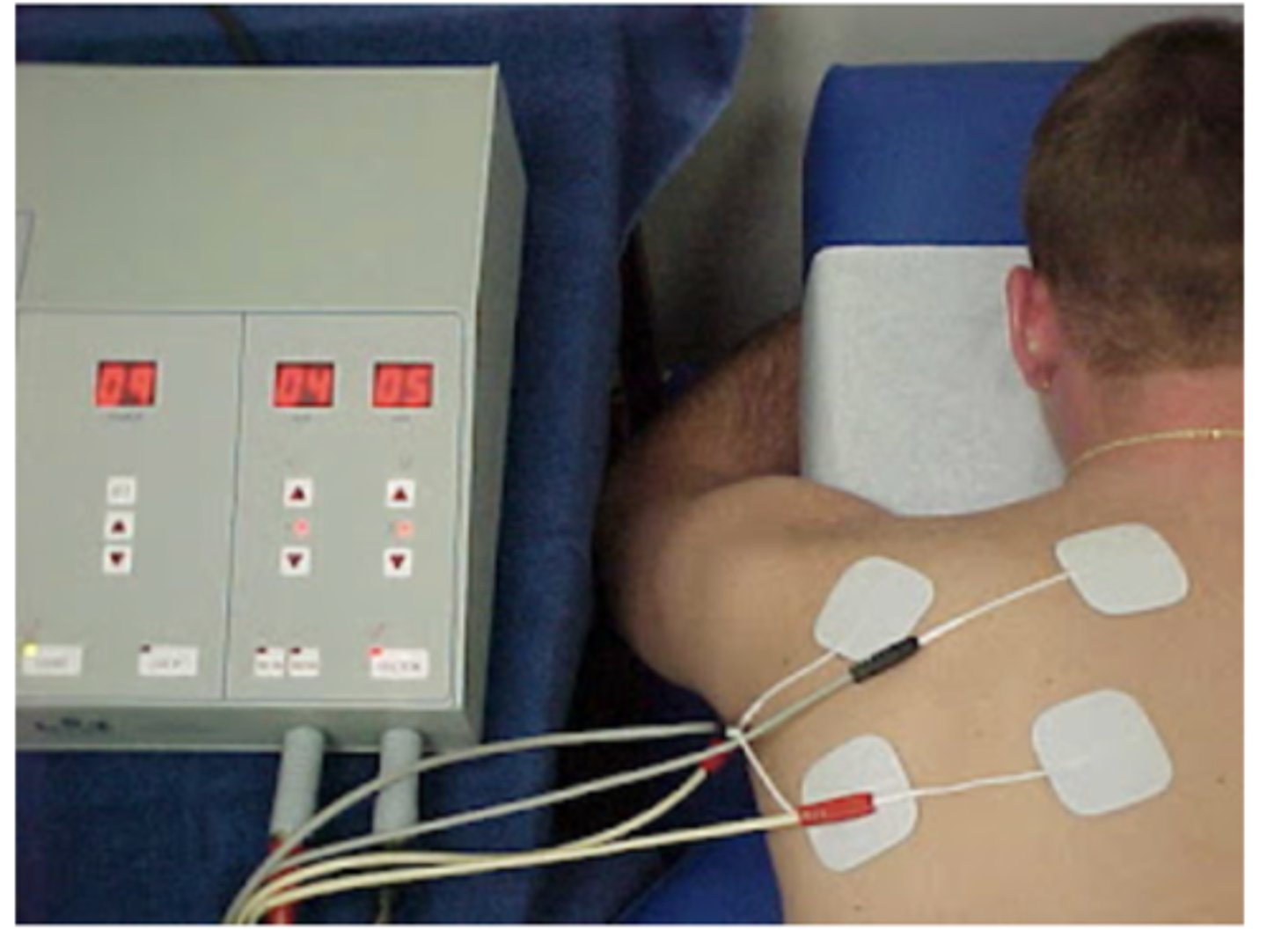<p>1. Ice</p><p>2. Therapeutic exercise</p><p>3. Electrical stimulation</p><p>4. Massage &amp; much more</p>