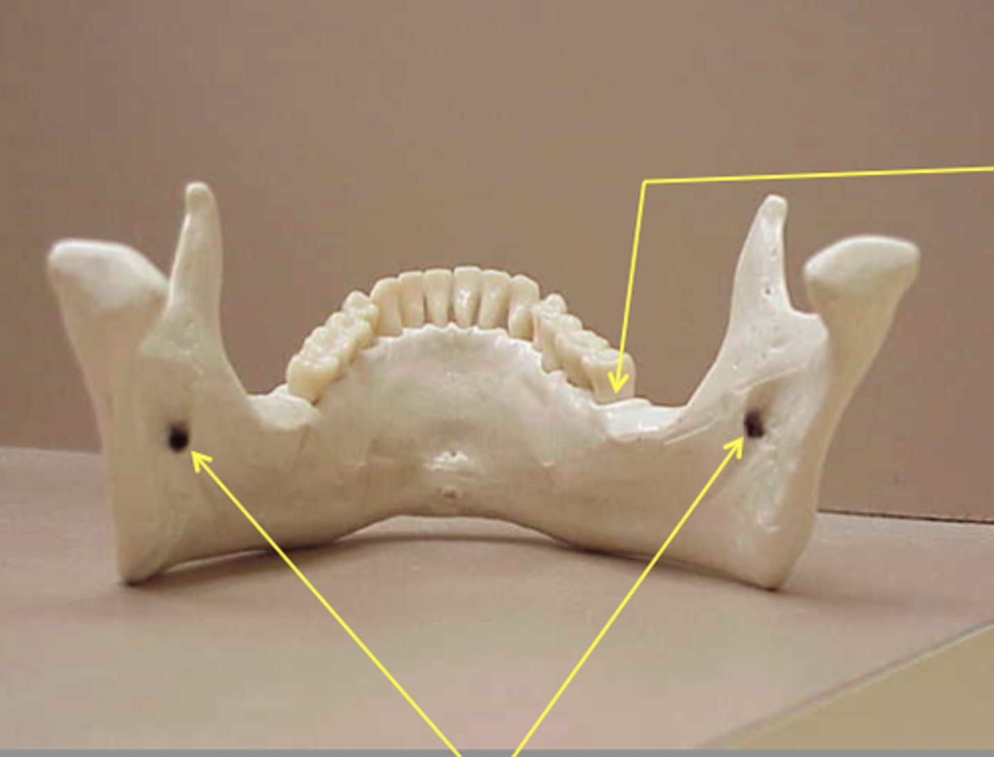 <p>Name this structure</p>