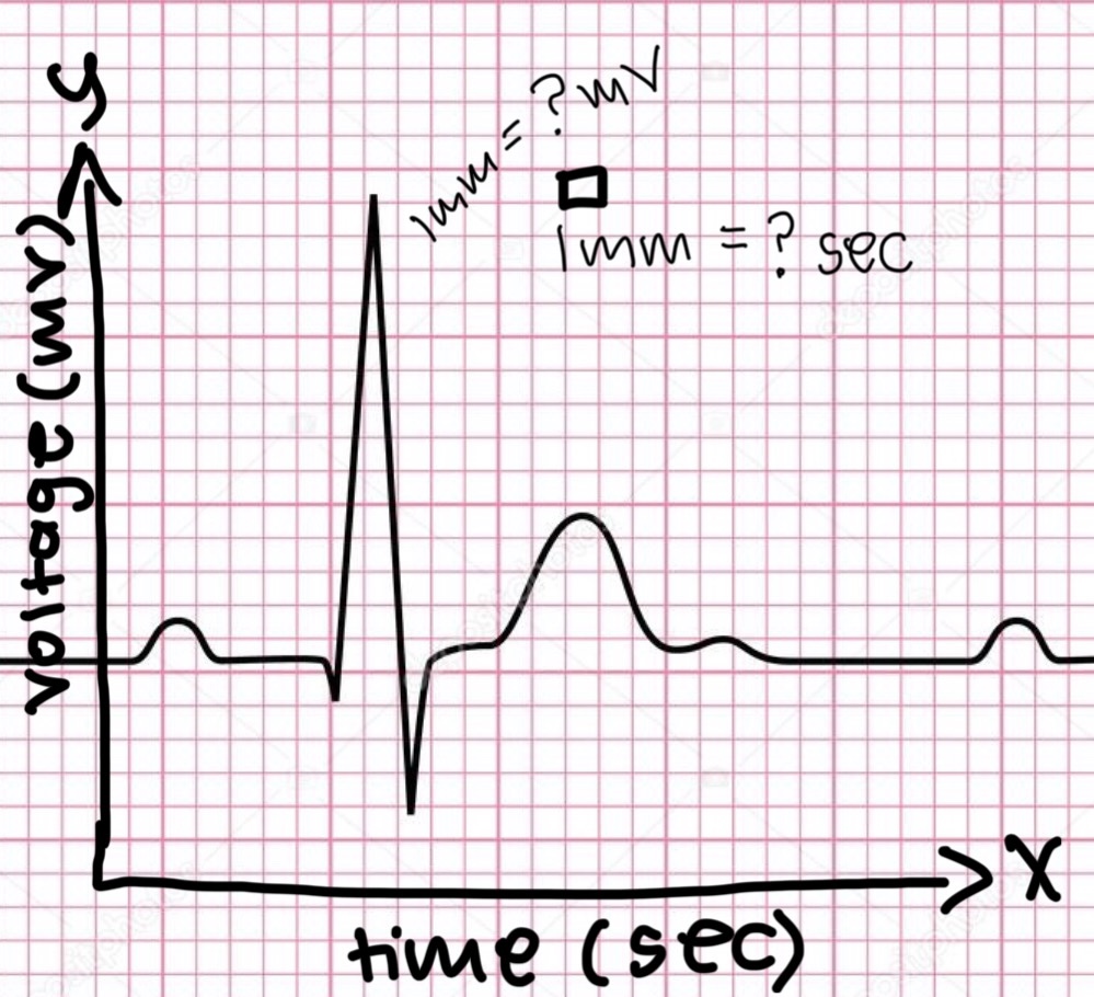 <p>The y axis is voltage in mV.</p><p>1mm equals ….. mV?</p>