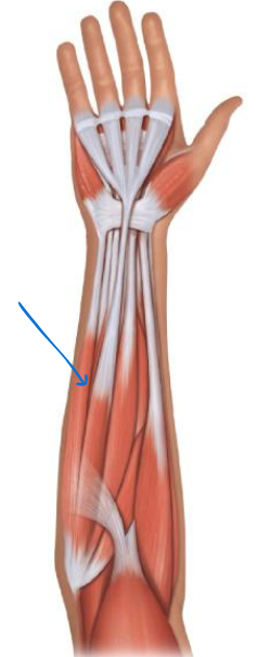 term image