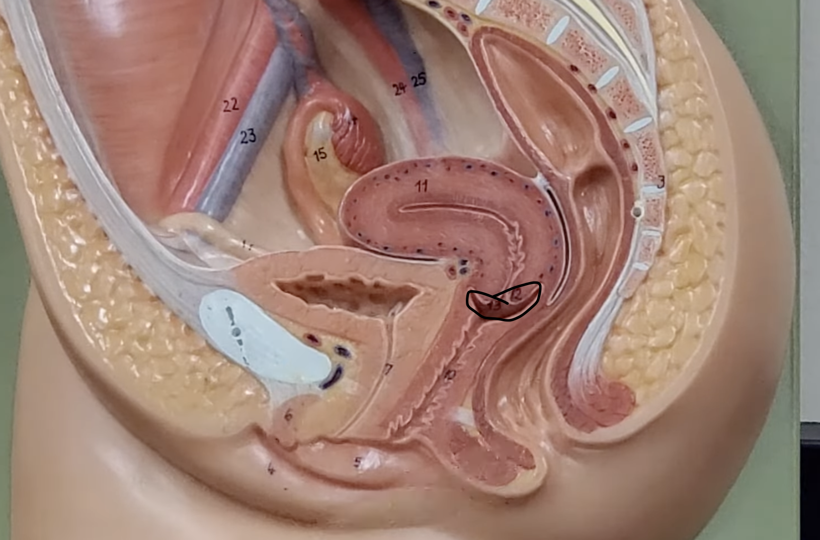 <p>known as the neck of the uterus and connects the uterus to the vagina</p>