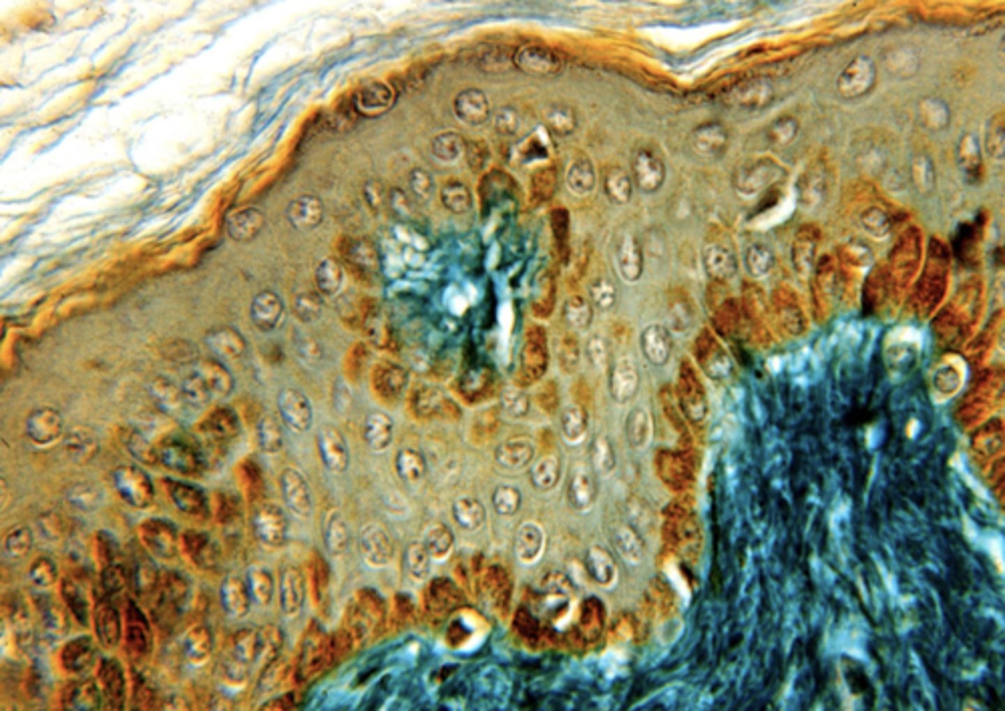 <p>What is the brown staining in this cell?</p>