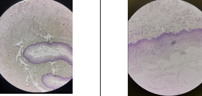 <p>Name this lab epithelium</p>