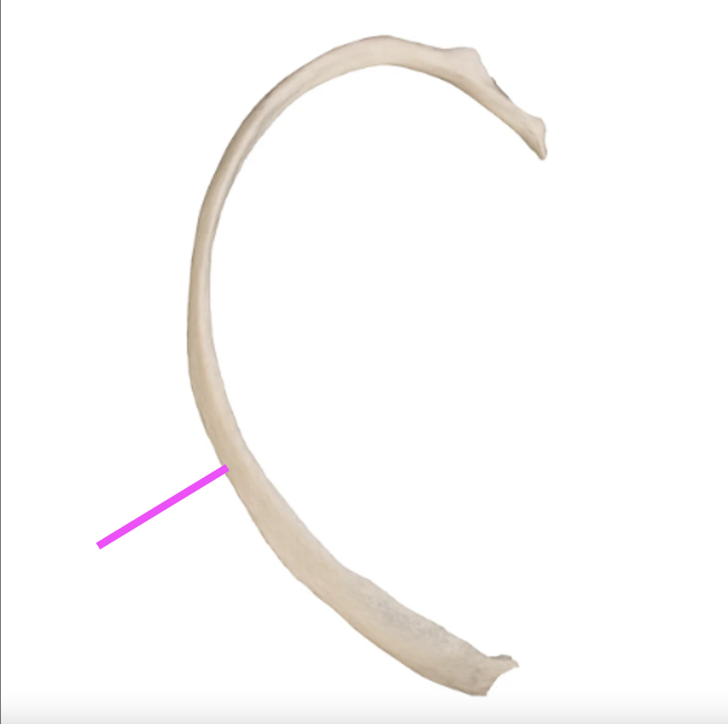 <p>What part of the rib is this?</p>