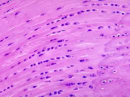 <p>Fibrocartilage </p>