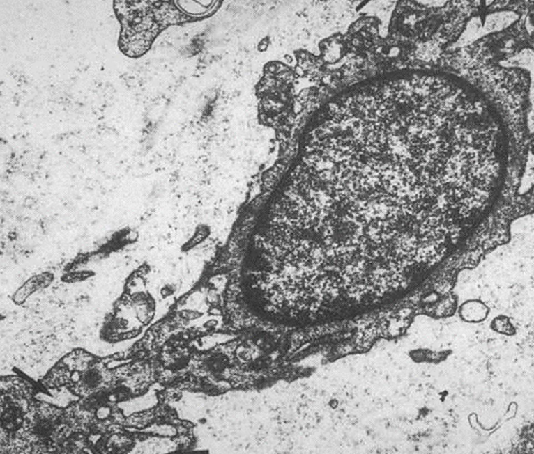 <p>Fibroblasts</p>