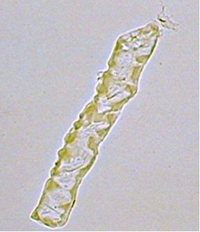 <p>What type of cast is pictured?</p>
