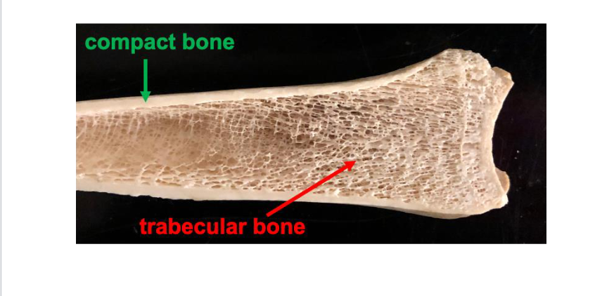 <p>Bone Tissue</p>